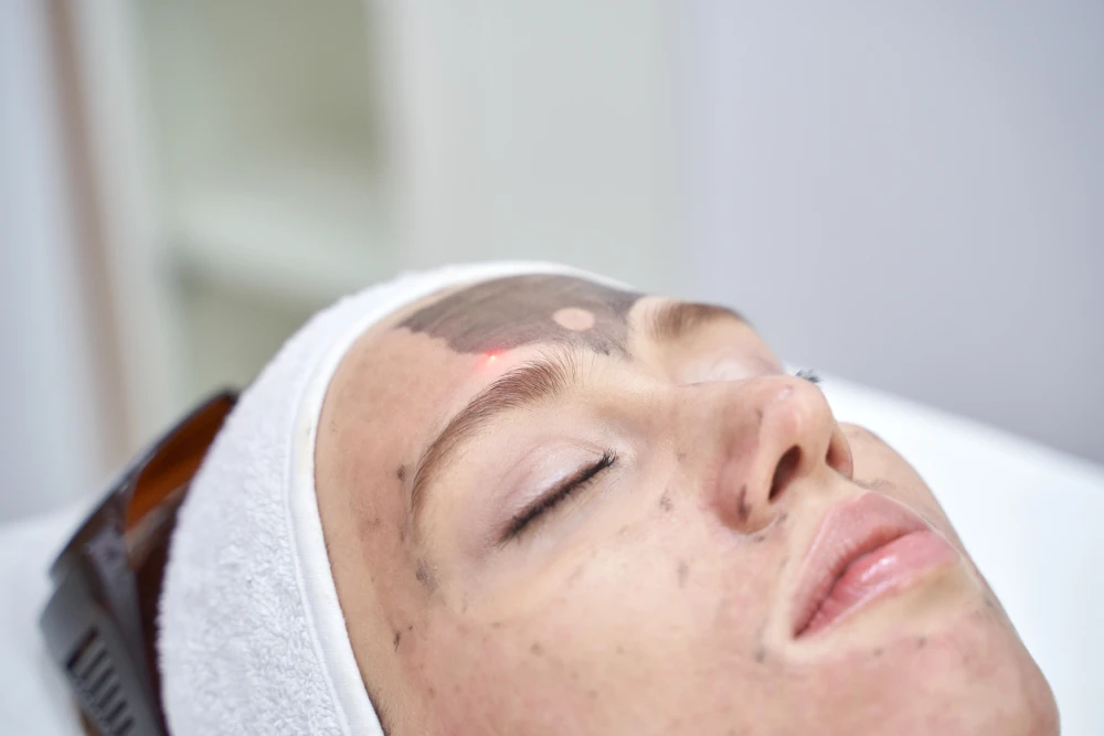 Laser resurfacing treatment at a med spa for smoother skin.